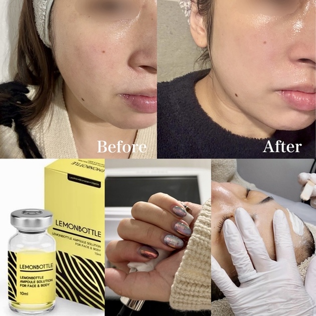 体験レポ】話題のレモンボトル×フェイスワックスで、ゆでたまご肌に