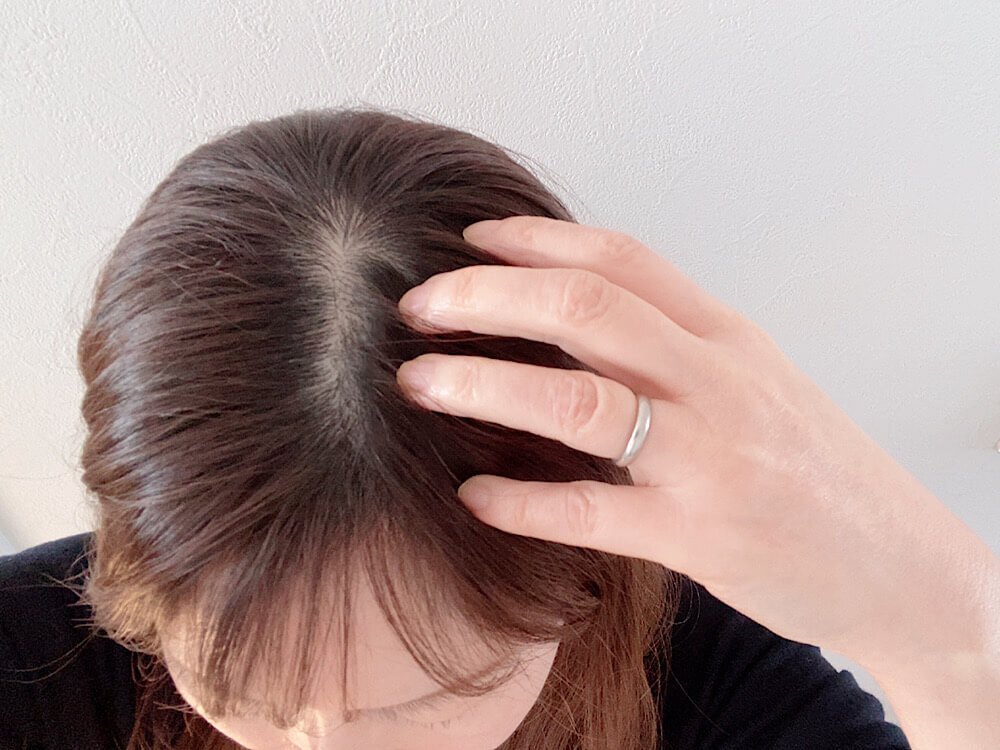 無印良品の「植物発酵液 薬用エイジングケアエッセンス」